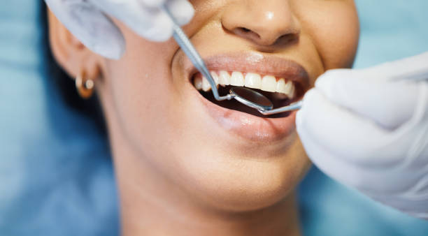 Best Broken or Cracked Tooth Emergency Dentist in El Segundo, CA