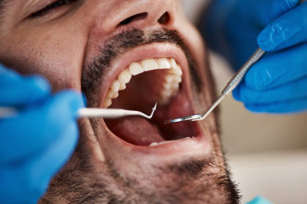 Best Pediatric Emergency Dentist in El Segundo, CA